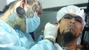 Tabu Latinoamerica

Emilio Gonzalez, modificador corporal venezolano, cuando realizaba la transformacion de las orejas de su paciente Cain, en su permanente busqueda de parecer el "diablo".  Anteriormente se habia hecho implantes de cachos y modificaciones en la nariz, ademas de tatuajes y piercings.